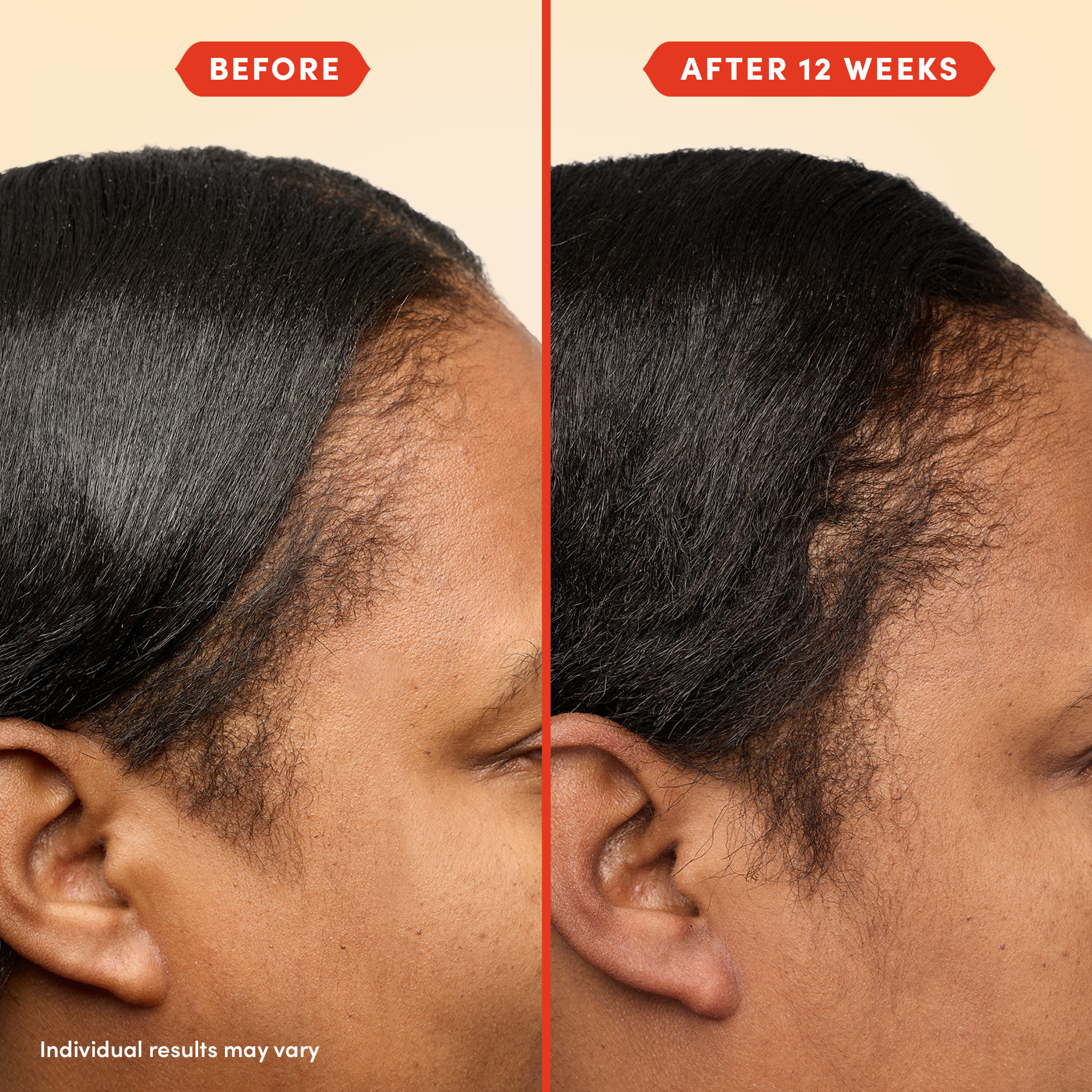 HoliRoots™ Hair Oil