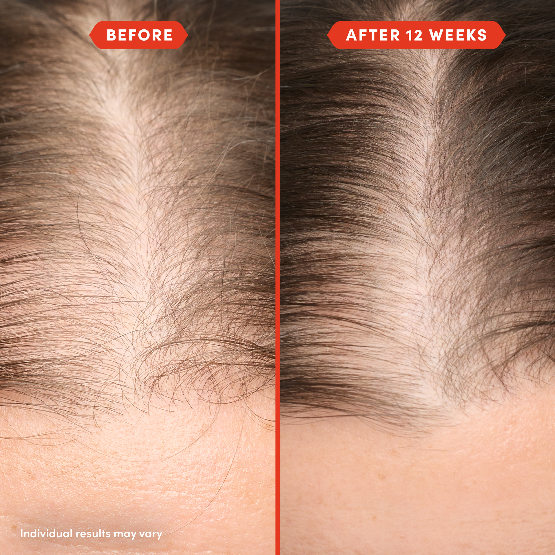 HoliRoots™ Hair Oil