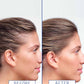 Hair Density Boosting Treatment