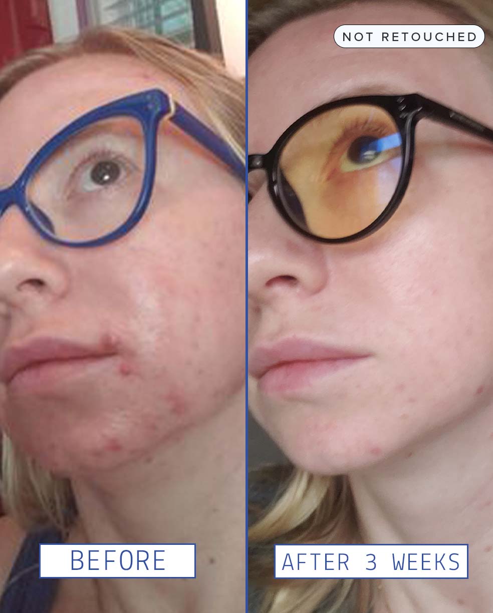 Glow Activating Exfoliator