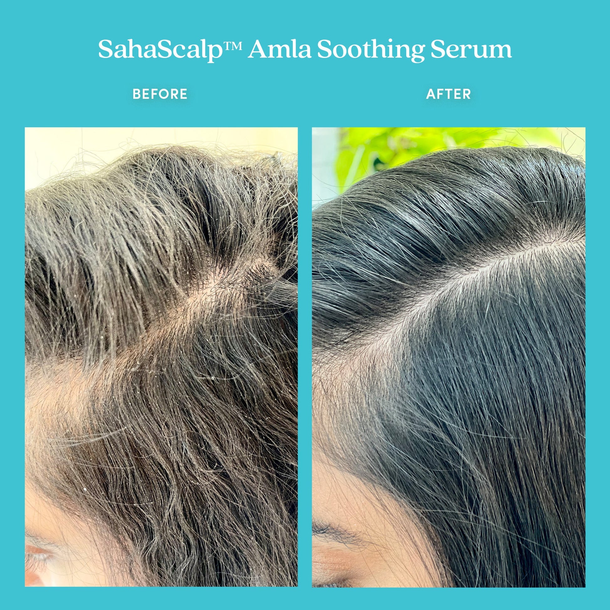 Mini SahaScalp™ Amla Soothing Serum