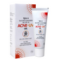 Ipca Acne UV Gel SPF 50 | Swadesiicart