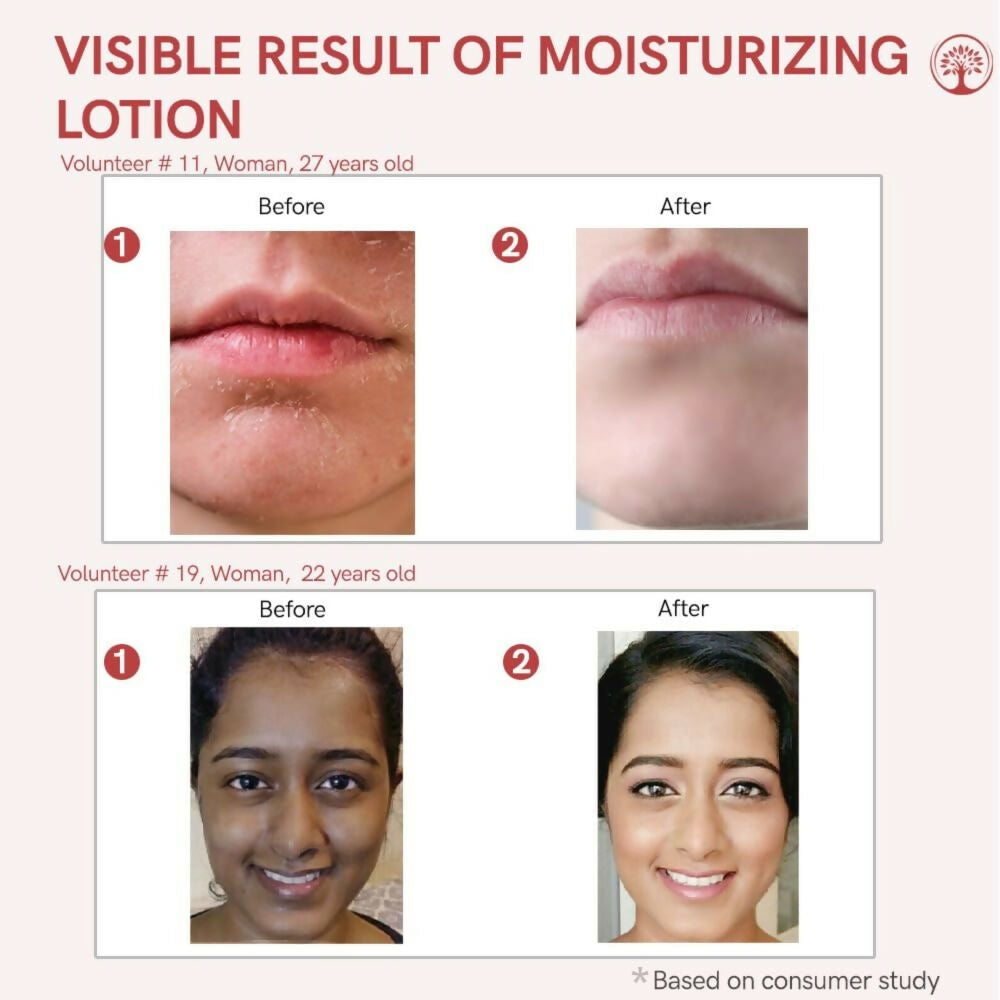 Ivory Natural Moisturizing Lotion Nourishes, Hydrates, And Revitalizes Dry Skin For Radiant Glow | Swadesiicart