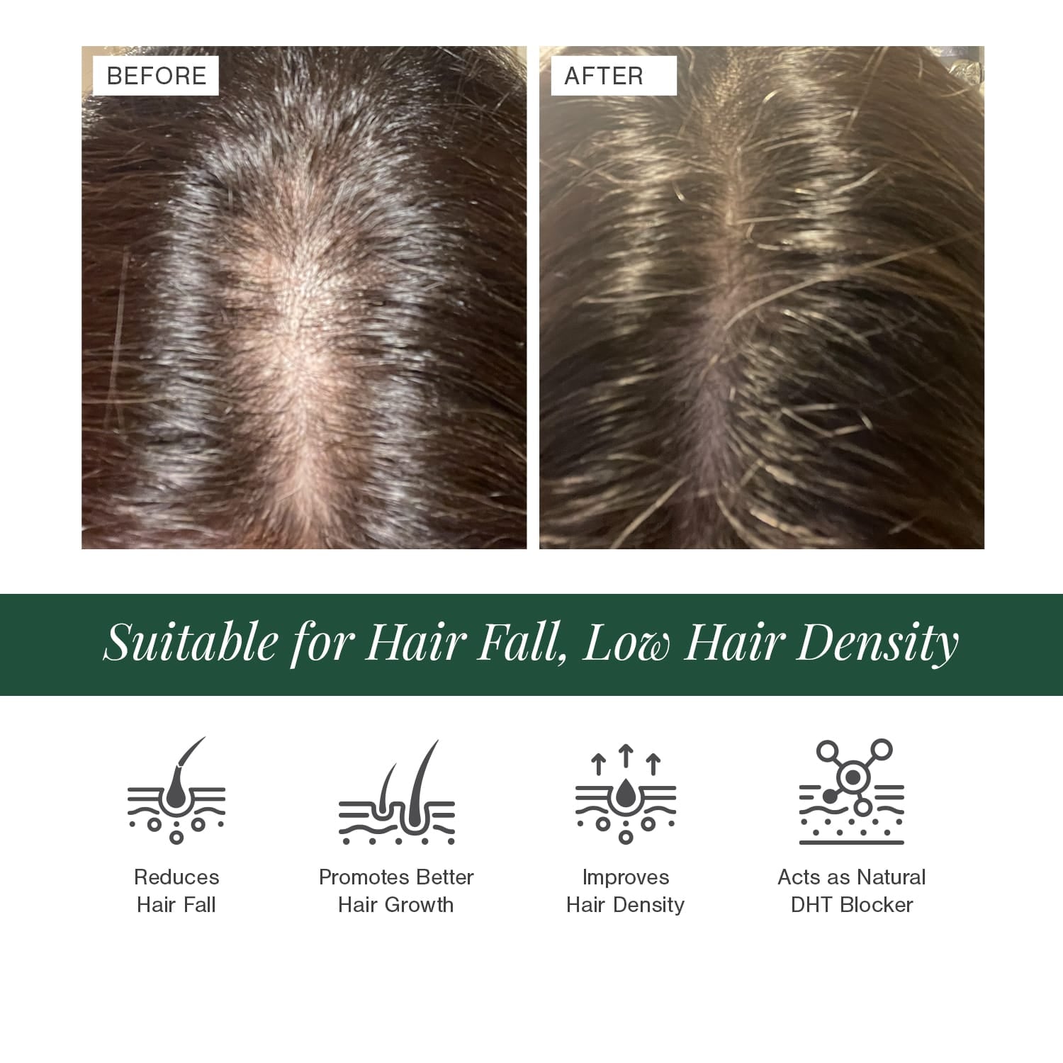 100% Natural Hair Growth Oil with Chilli + Rosemary