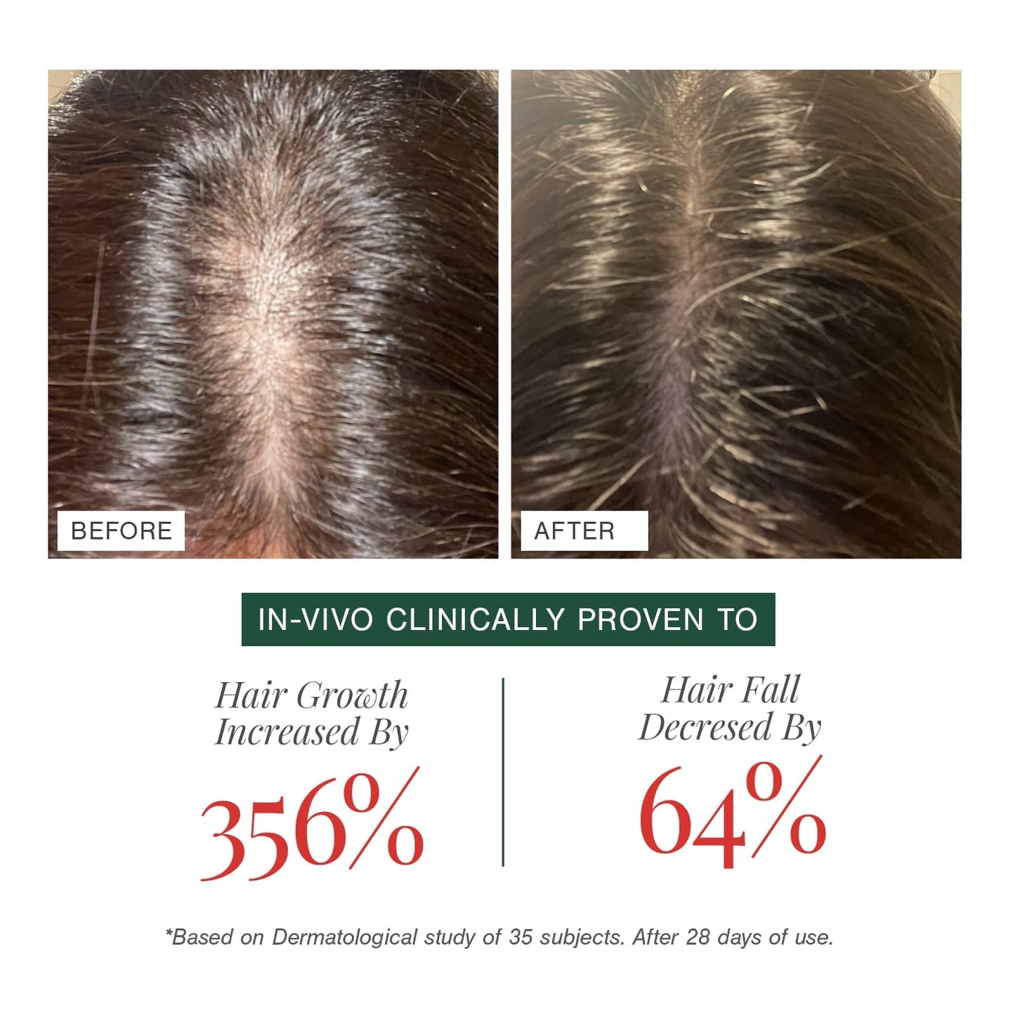 100% Natural Hair Growth Oil with Chilli + Rosemary