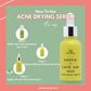 House of Beauty Acne Drying Serum - Swadesiicart
