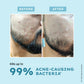 Hyphen By Kriti Sanon Clarifying Acne Cleanser With 2% Salicylic Acid, Anti-Acne Face Wash For Oil Control - Swadesiicart