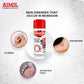 Aimil Dermacharge Powder | Swadesiicart