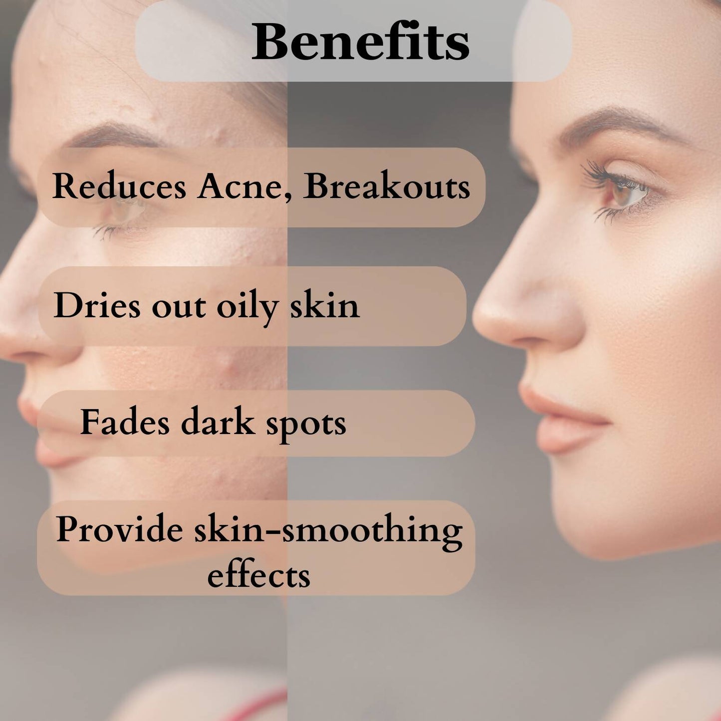 Dermistry Salicylic Acid Anti Acne Face Serum & Anti Acne Foaming Face Wash - Swadesiicart
