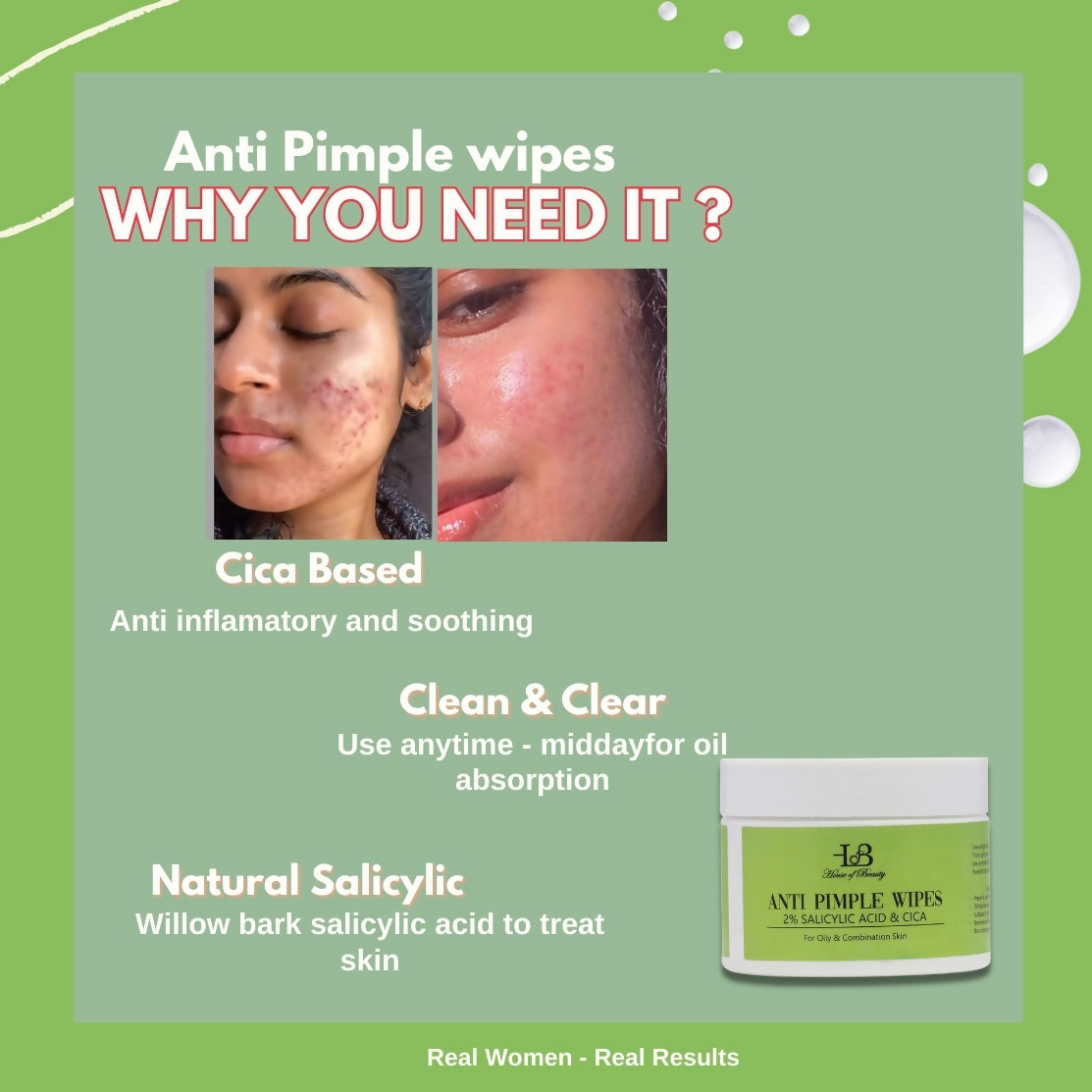 House of Beauty Anti Pimple Wipes - Swadesiicart