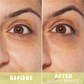 Wishful By Huda Beauty Eye Lift & Contour 1% Bakuchiol & Peptide Serum - Korean Skincare | Swadesiicart