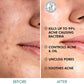 mCaffeine 2% Salicylic Acid Serum Clear Skin Acne Pads - Acne & Oil Control with Matcha Tea - Swadesiicart