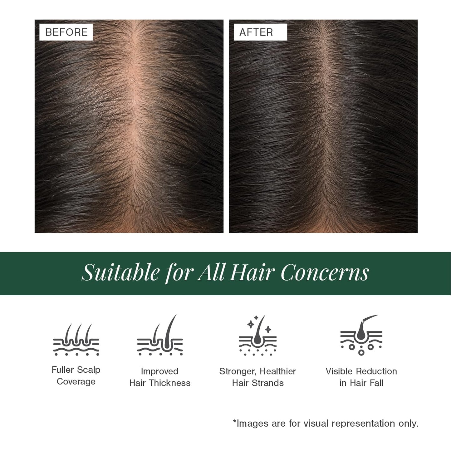 Stemcells + Multi-Peptide Hair Growth Serum Fortified With Redensyl & Anagain
