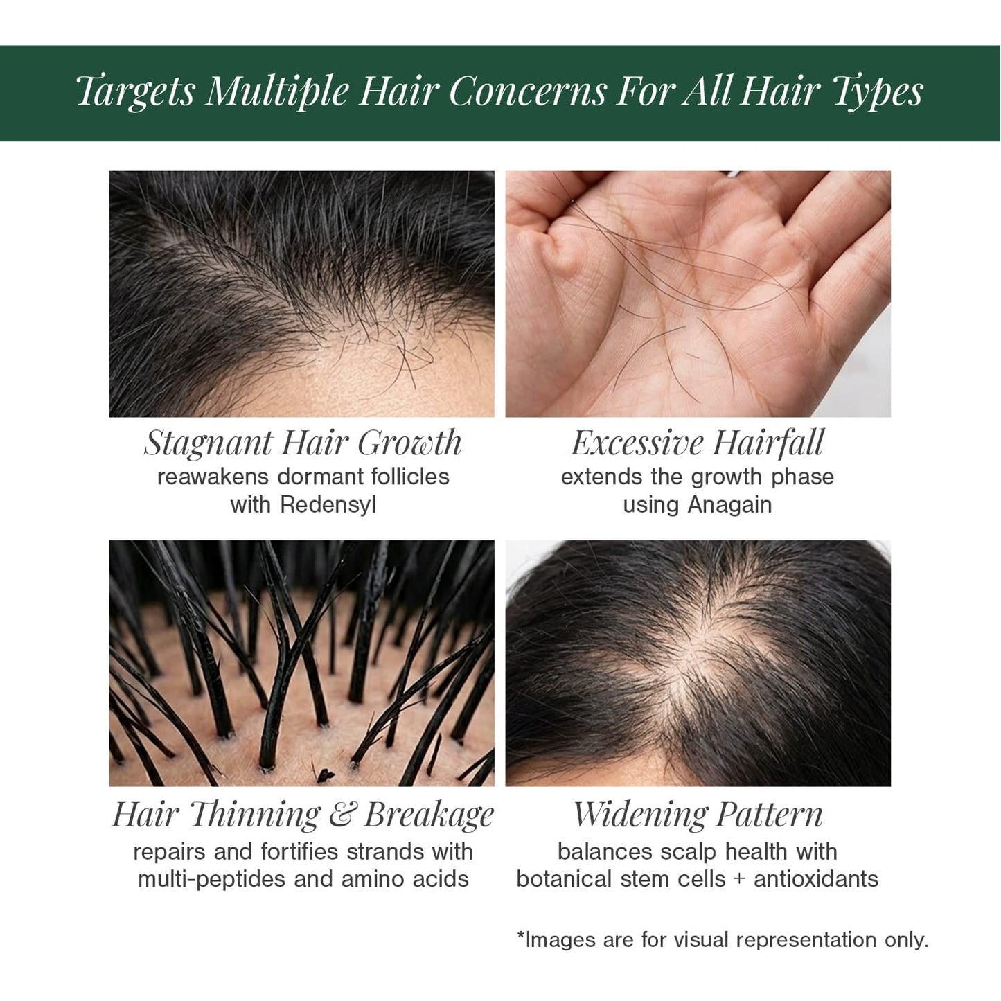 Stemcells + Multi-Peptide Hair Growth Serum Fortified With Redensyl & Anagain