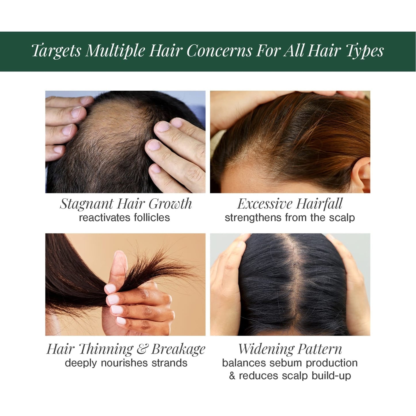 Hair Oil for Premature Greying Fortified with Hibiscus + Bhringaraj