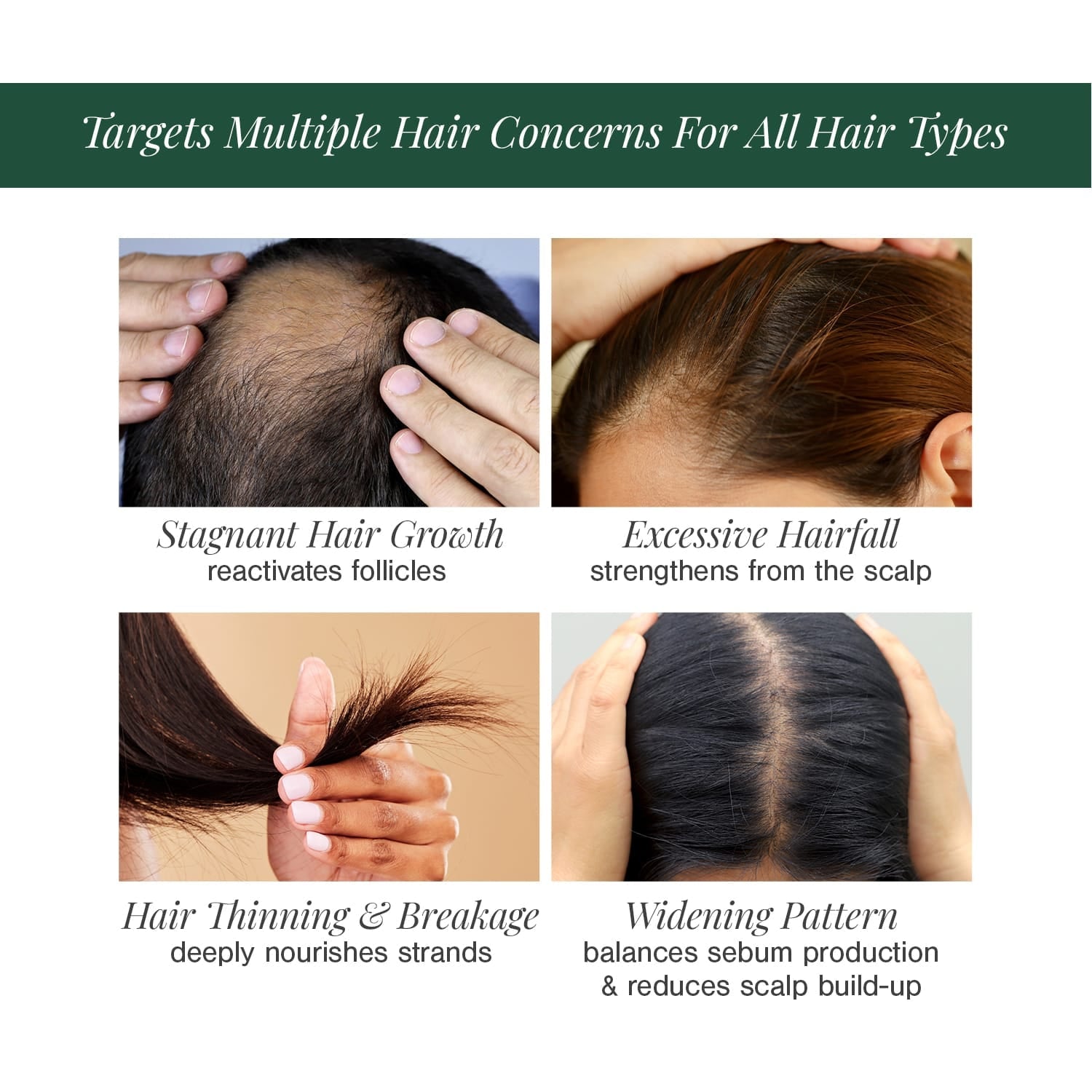 Hair Oil for Premature Greying Fortified with Hibiscus + Bhringaraj