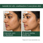 Certified Organic Acne & Pimples Control Face Wash Fortified with Hemp + Tea Tree