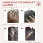 Ivory Natural Dandruff Hair Mist For Flake-Free Confidence And Silky Smooth Hair | Swadesiicart