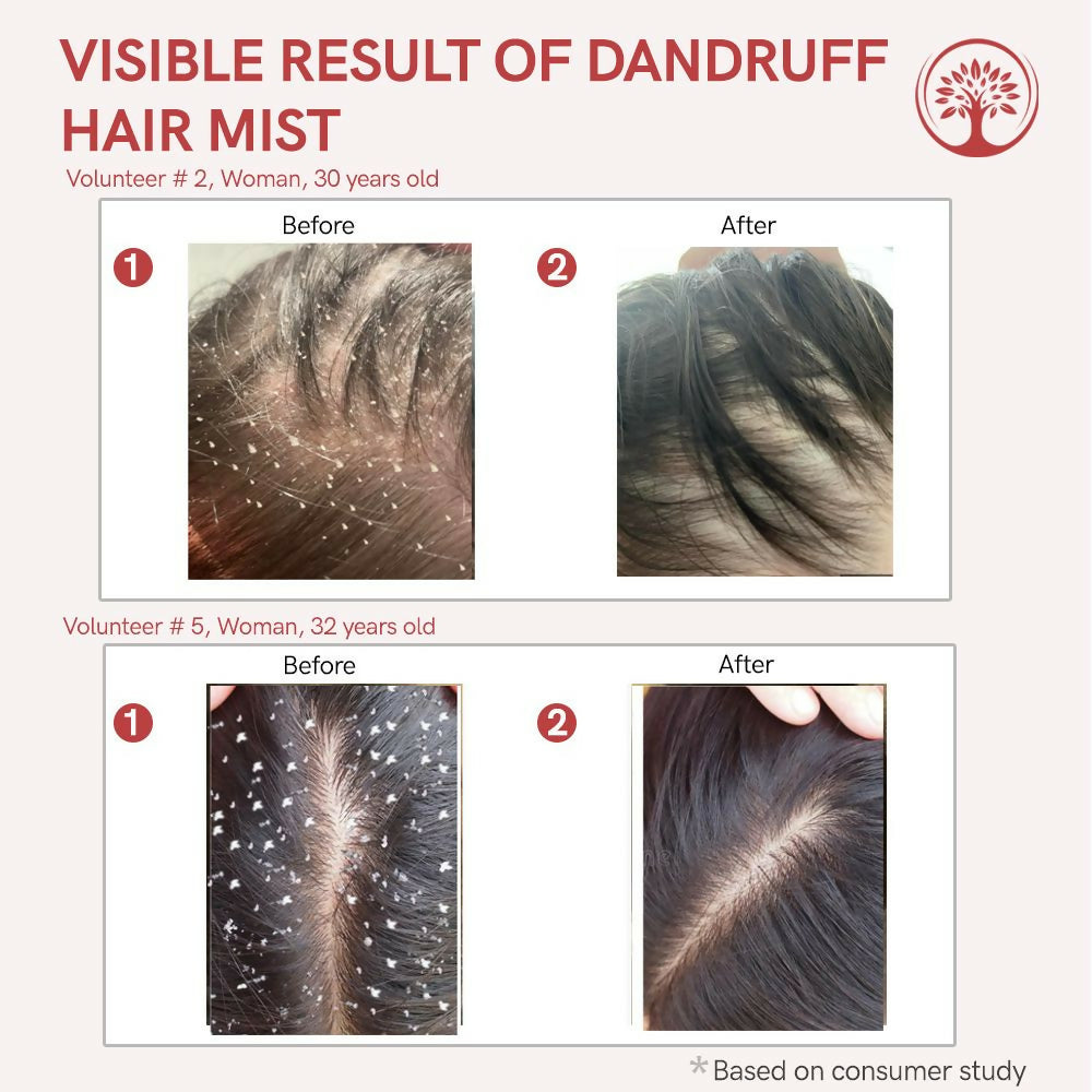 Ivory Natural Dandruff Hair Mist For Flake-Free Confidence And Silky Smooth Hair | Swadesiicart