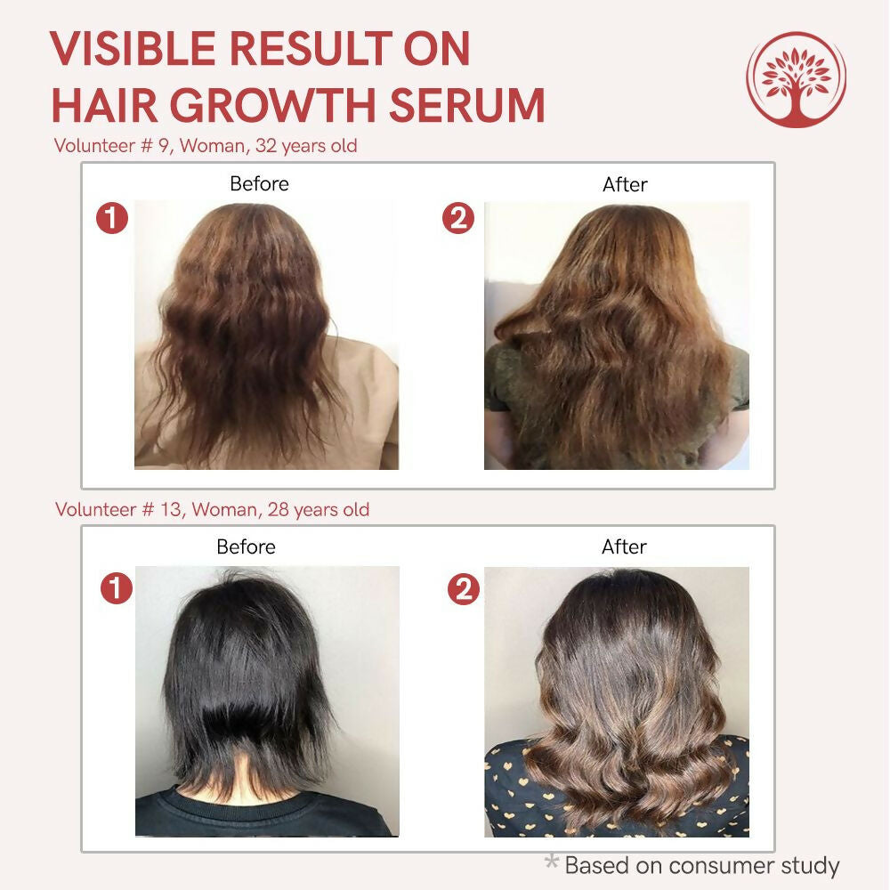 Ivory Natural Serum For Growth Of Hair For New Hair Roots & Encouraging Growth Of Hair | Swadesiicart