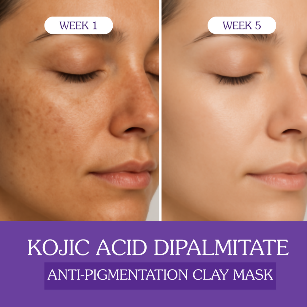Bake Kojic Acid Anti-Pigmentation Clay Mask | Swadesiicart