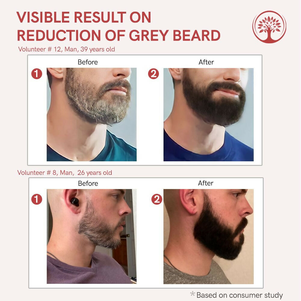 Ivory Natural Greys Beard Serum Restore Natural Black Color Of Grey White Beard | Swadesiicart