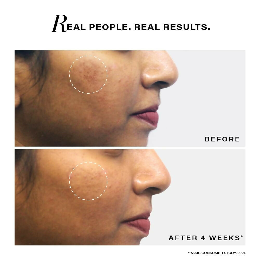 Novology Pigmentation Reduction Serum For Dark Spots - Swadesiicart