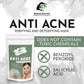 Beauty Secrets Anti Acne Face Mask - Swadesiicart