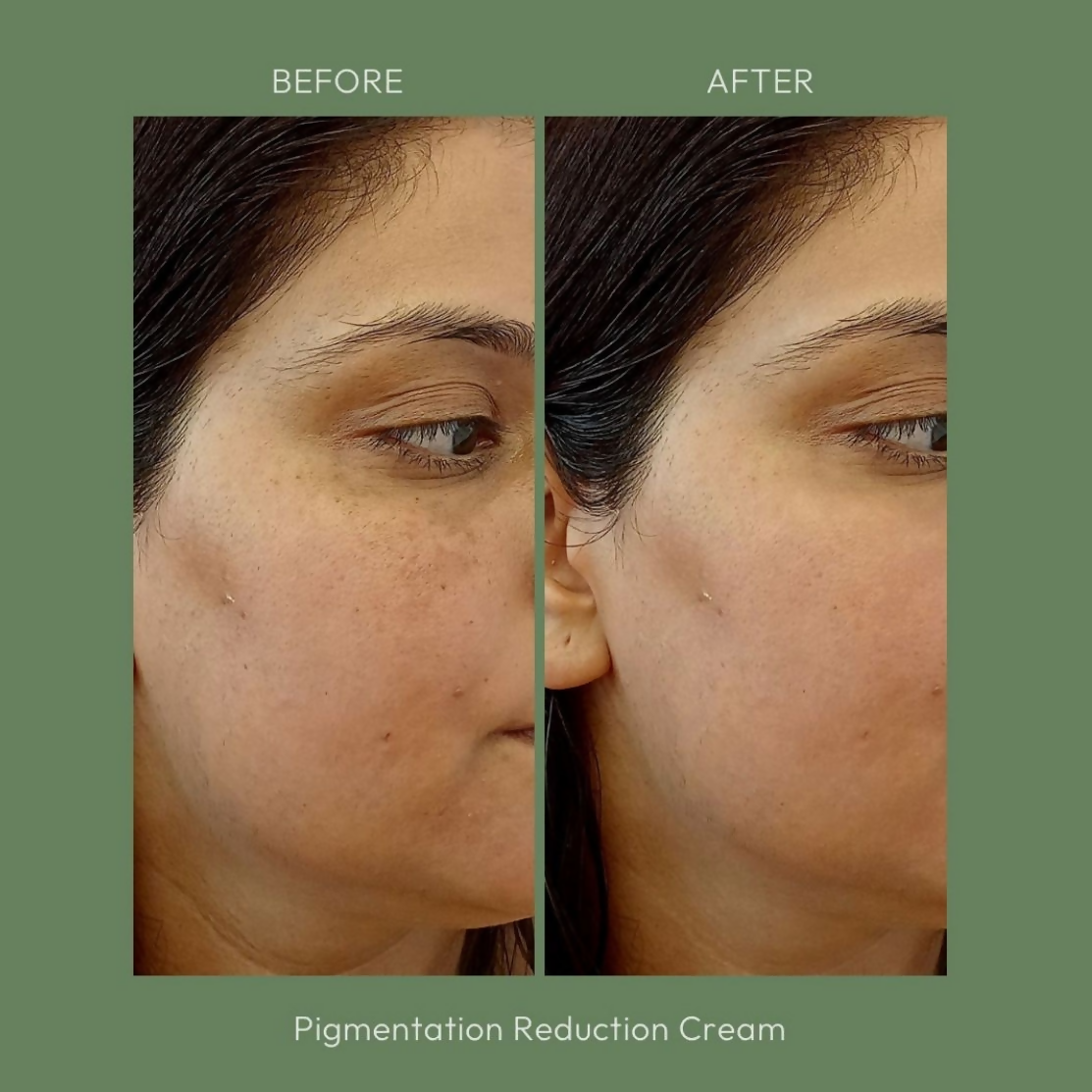 House of Beauty Pigmentation Reduction Cream - Swadesiicart