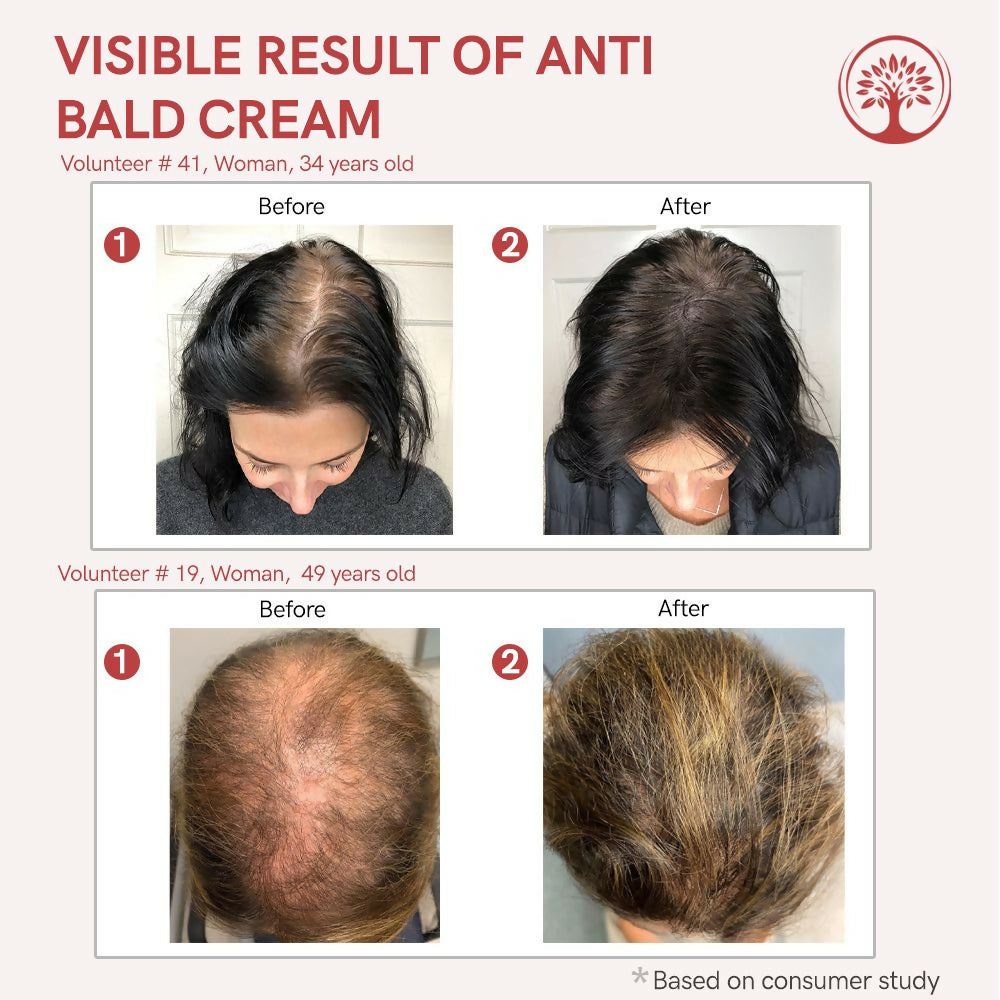 Ivory Natural Bald Cream For Hair For Stimulate Growth Of Hair, Avoid Thinning | Swadesiicart