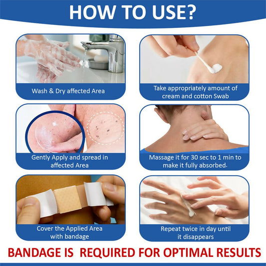 7 Days Natural Wart Remover Cream with AHA- BHA - Swadesiicart