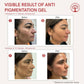 Ivory Natural Pigmentation Gel For Fade Dark Spots & Pigmentation | Swadesiicart