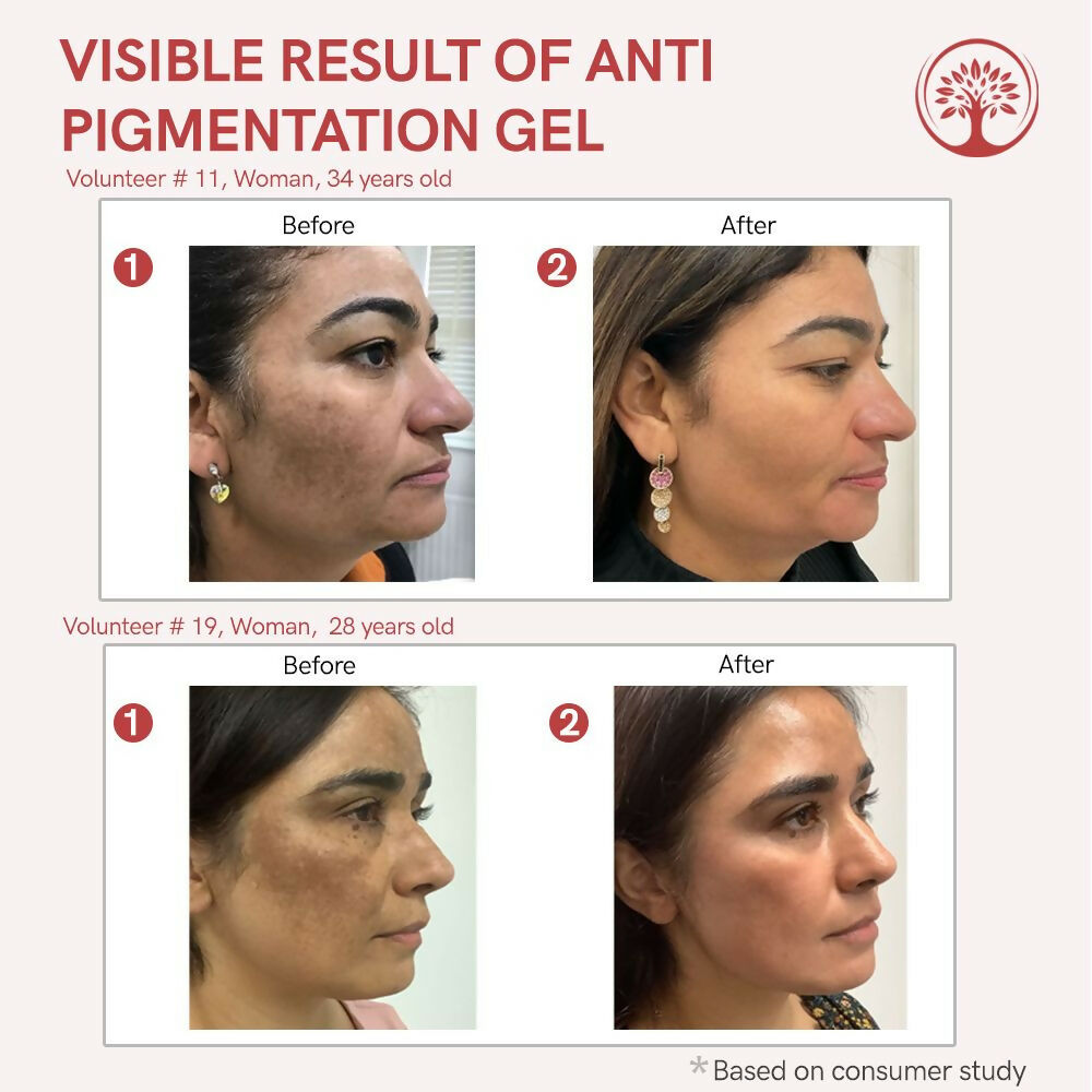 Ivory Natural Pigmentation Gel For Fade Dark Spots & Pigmentation | Swadesiicart