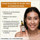 myUpchar Ayurveda 2% Salicylic Acid + Zinc PCA Anti Acne Face Serum | Swadesiicart