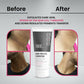 Thriveco Dark Patches Corrector Cream | Swadesiicart