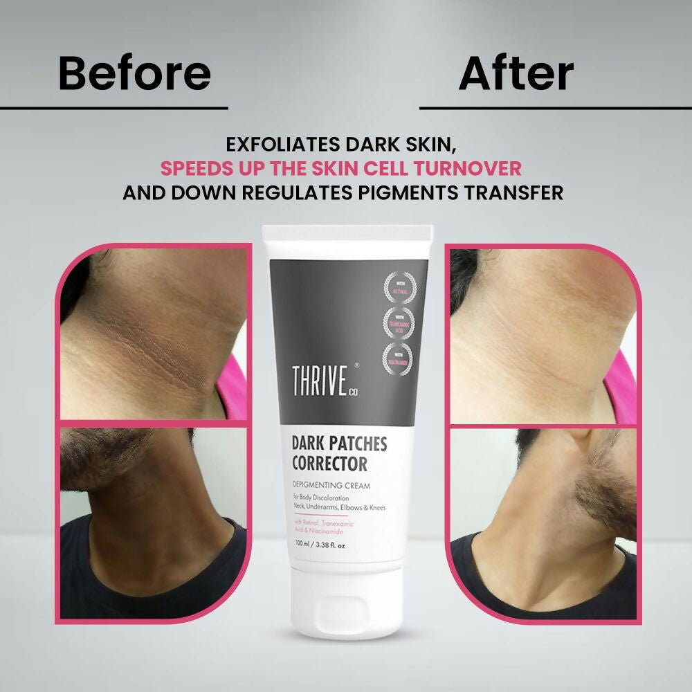 Thriveco Dark Patches Corrector Cream | Swadesiicart