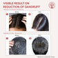 Ivory Natural Dandruff Hair Serum For Nourishing Dry Scalp | Swadesiicart