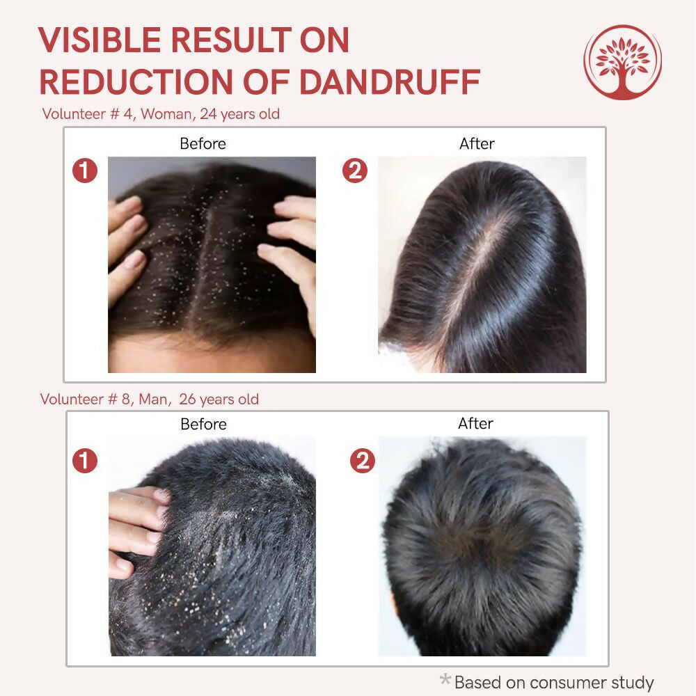 Ivory Natural Dandruff Hair Serum For Nourishing Dry Scalp | Swadesiicart