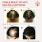 Ivory Natural Hair Fall Hair Mask - Loss Of Hair Control For Both Men & Women | Swadesiicart