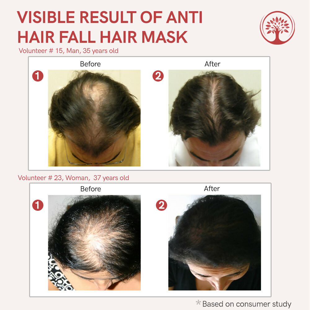 Ivory Natural Hair Fall Hair Mask - Loss Of Hair Control For Both Men & Women | Swadesiicart