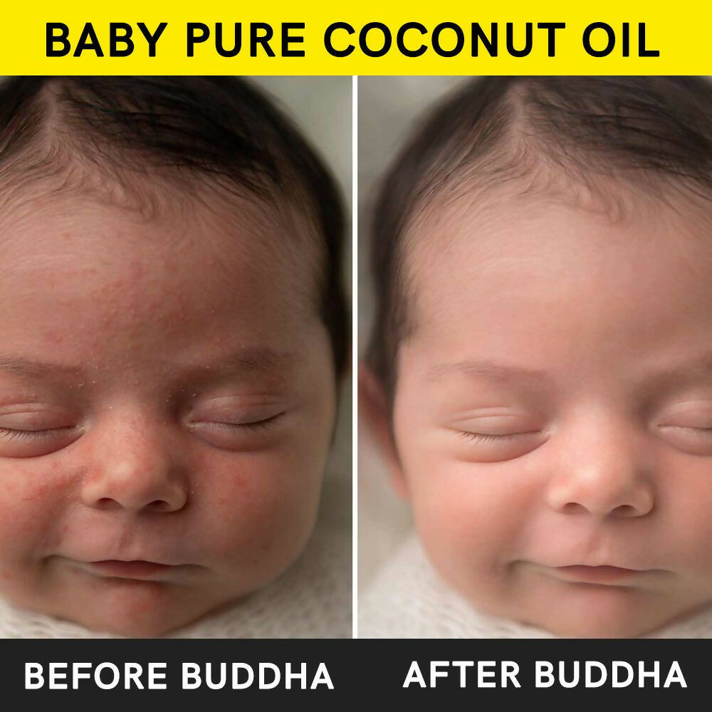 Buddha Natural Baby Coconut Oil Extra Virgin Wood Pressed - Swadesiicart