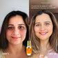 Timeless Kumkumadi Oil: Special Offer