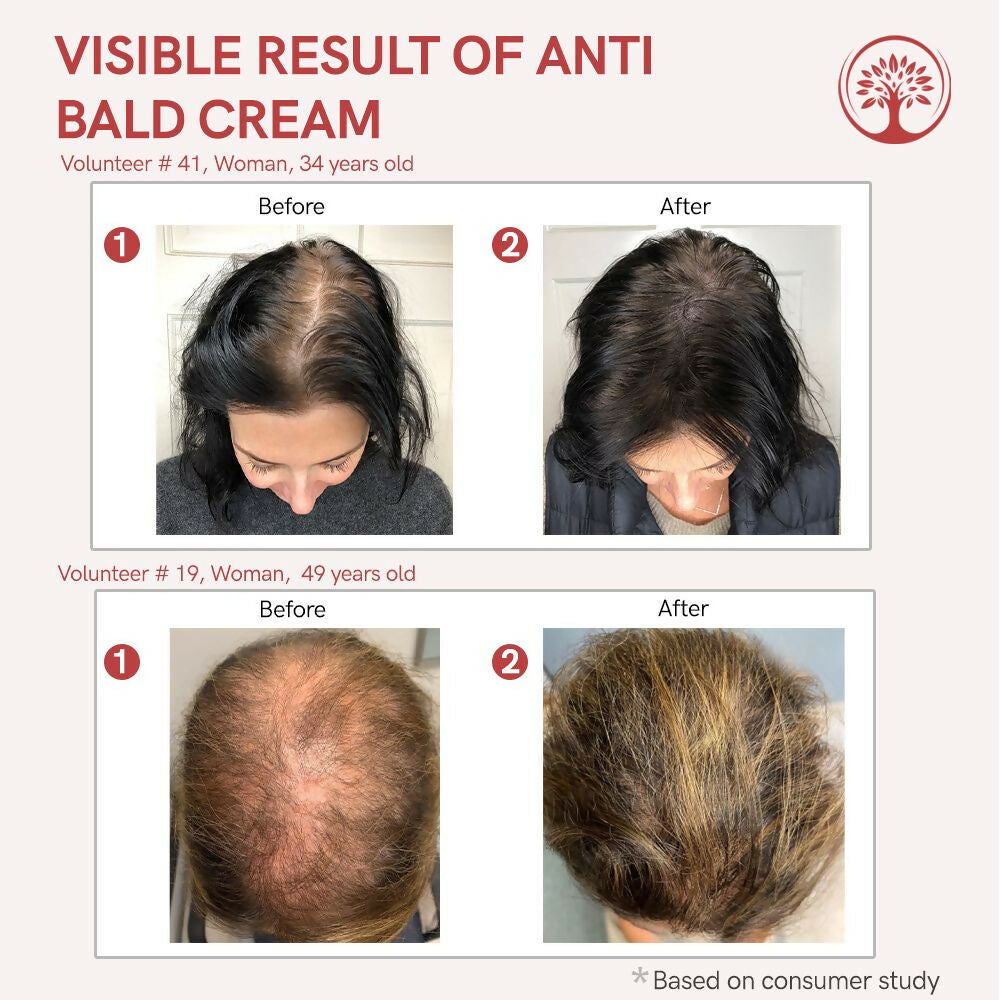 Ivory Natural Grey Combo For Hair - Natural Solution For Greys, Restore Natural Black And Shine Of Hair | Swadesiicart