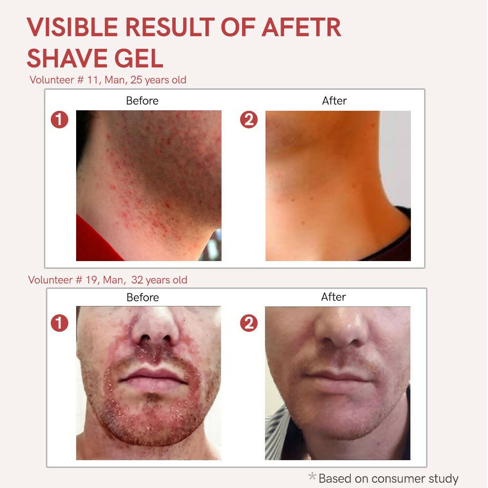 Ivory Natural After Shave Gel For Gentle Post-Shave, Reduced Facial Worries | Swadesiicart
