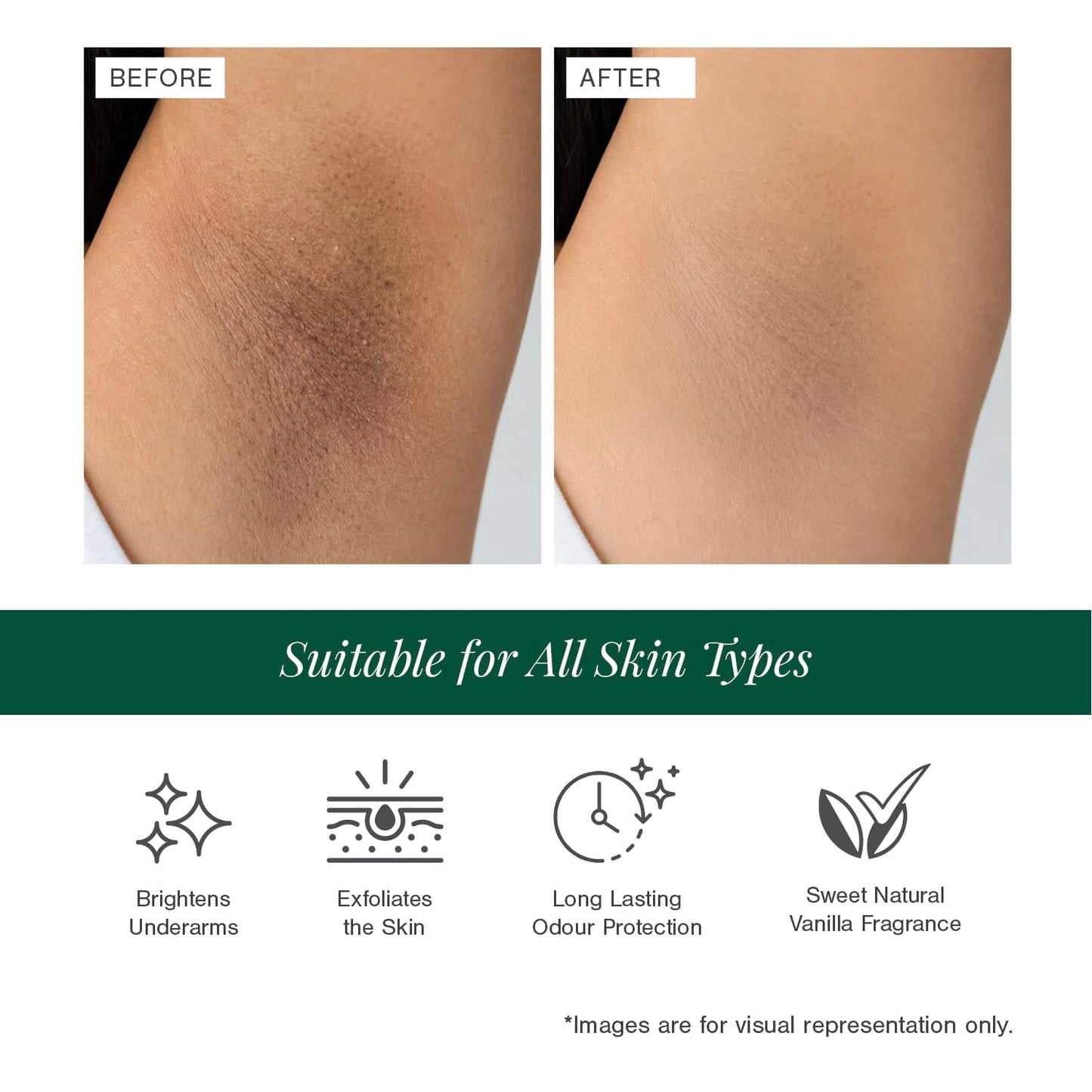 5% AHA + 2% BHA Underarm Roll-on Deodorant Fortified with Vanilla + Witch Hazel