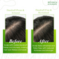 Botanical Luxuriate Amla & Rosemary Anti-Dandruff Shampoo