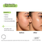 Nature Derma Moisture Replenish Night Cream | Swadesiicart