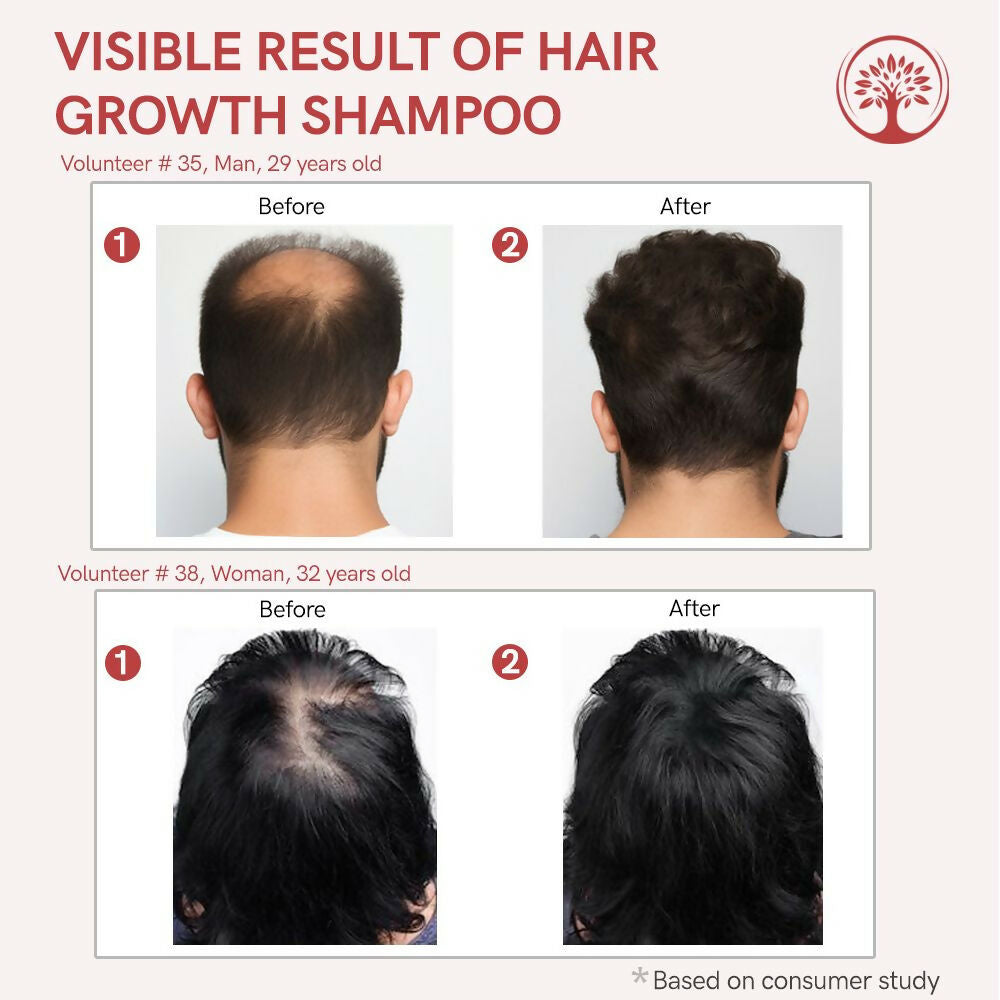Ivory Natural Hair Shampoo For Growth - Hair Wellness & Nourishment For Both Men And Women | Swadesiicart