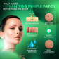Urban Yog Acne Pimple Patch - 36 Dots | Swadesiicart
