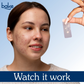 Bake Acne Erase XL Pimple Patches | Swadesiicart